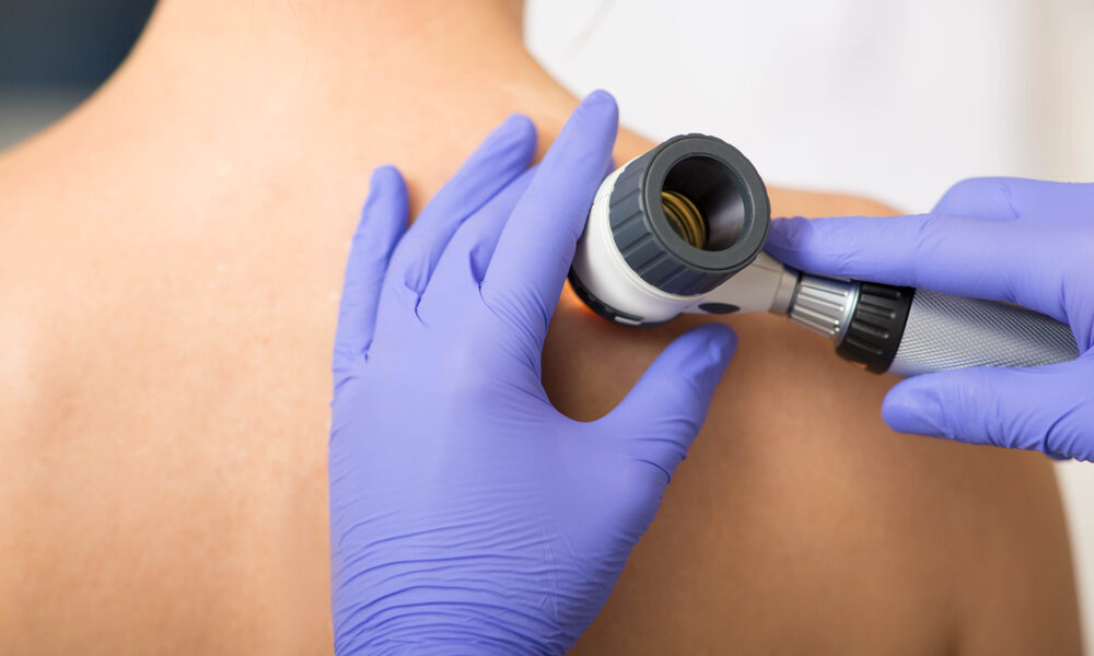 A Comprehensive Guide to Choosing Dermatology Services